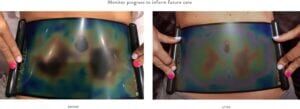 Body Sculpting brown Adipose